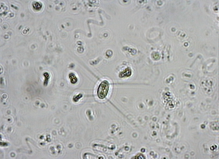 Dictyocha speculum